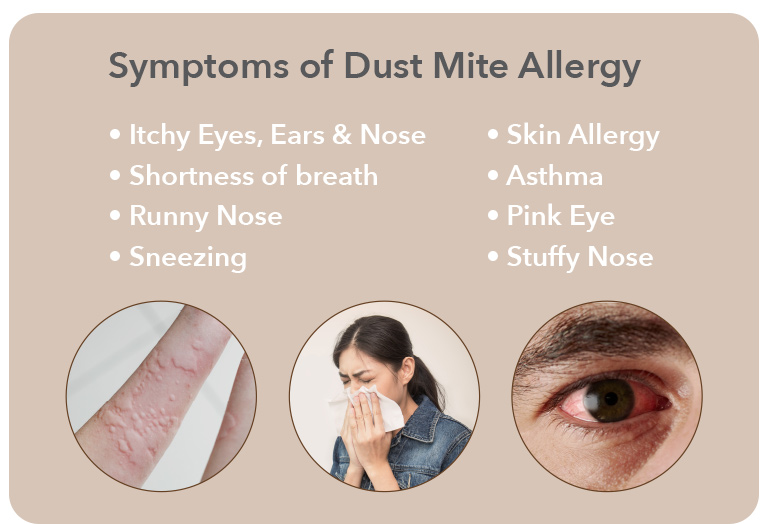 Dust Mite Allergy Symptoms - Coway Mattress Care Mobile Page